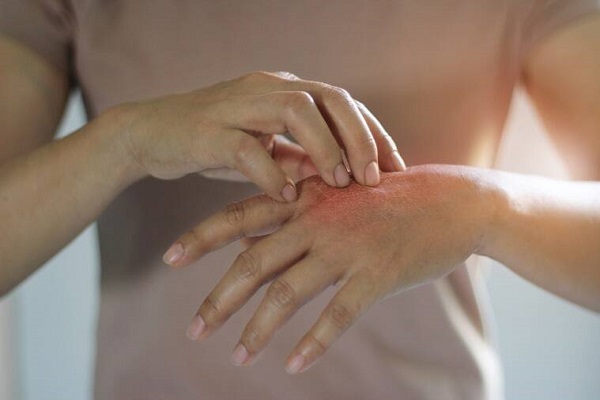 اثرات مایع ظرفشویی بر پوست دست
