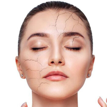 روش های ساده برای رفع خشکی پوست صورت